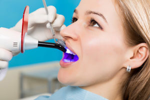 Dental Bonding | General Dentistry | Dentistry in Texas