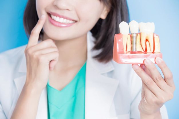 dental implants dentist showing model of dental implants