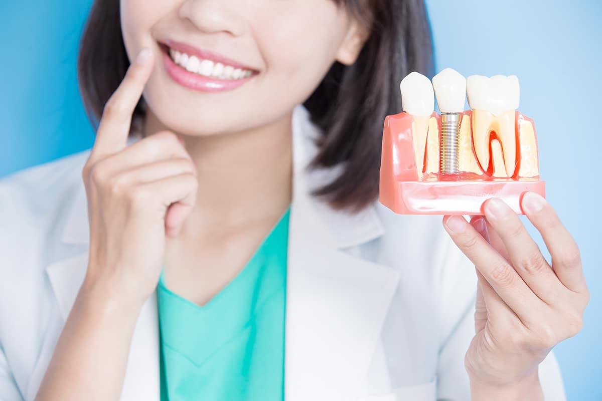 dental implants dentist showing model of dental implants